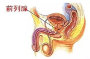 前列腺灸使用方法,一、前列腺灸的原理