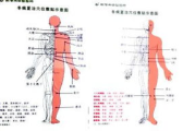 揭秘穴位贴敷的神奇疗效- 传统中医的现代魅力！